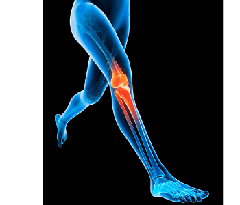 Cum să întărească articulațiile și ligamentele genunchilor